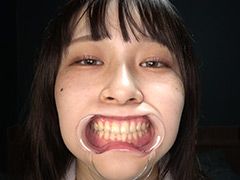 桐谷すずねチャンの激レア口内・歯・舌ベロ観察！