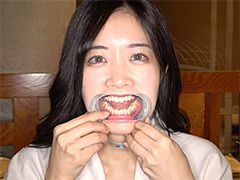 初めての口内・のどちんこ観察！ことね（5）